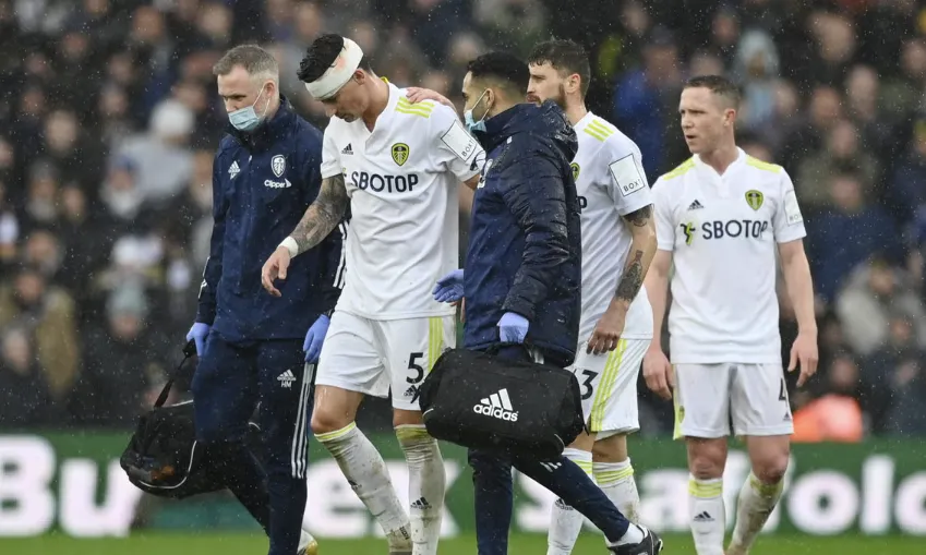 The Human Element: Taking the Decision Away from Players